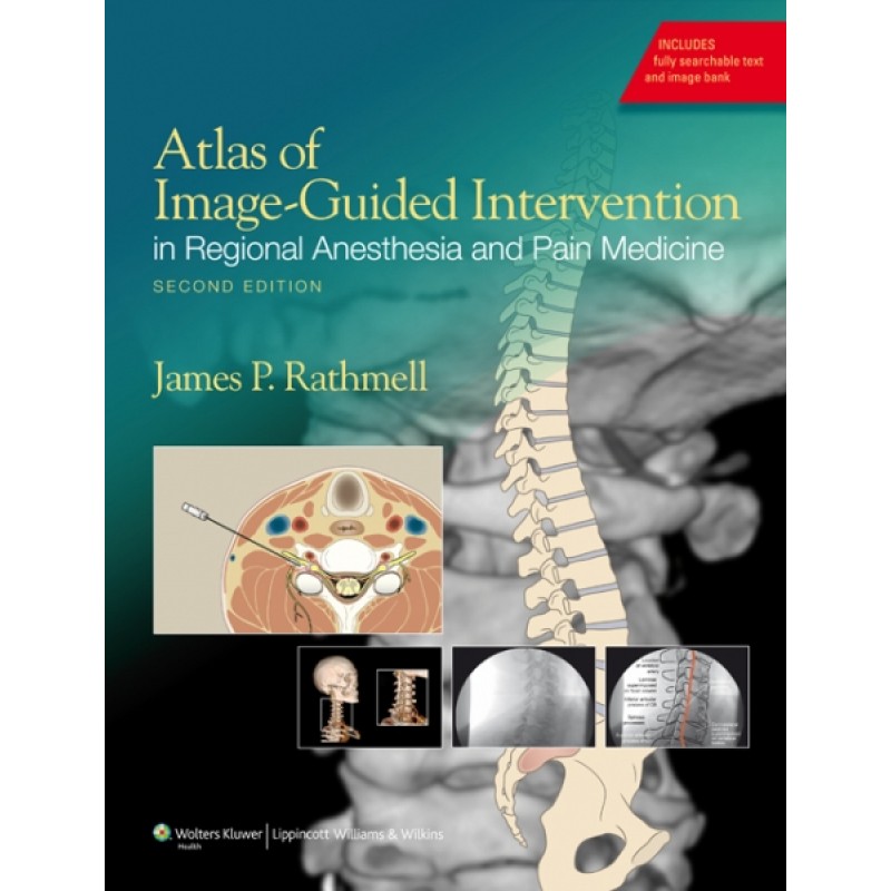 Atlas of Image-Guided Intervention in Pain Medicine 2nd edition